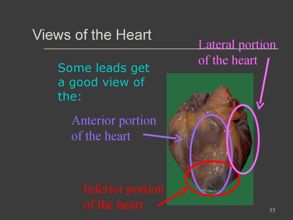 Views of the Heart