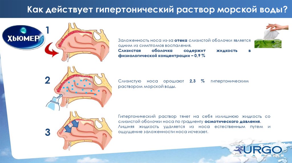 Гипертонический раствор. Гипертонический раство. Гипертогнический раст. Гиперемический раствор.