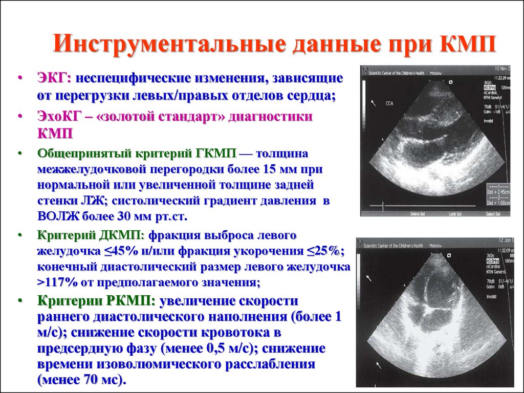 Дилатация изображения это