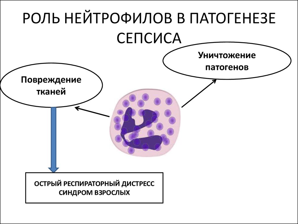 Схема патогенеза сепсиса