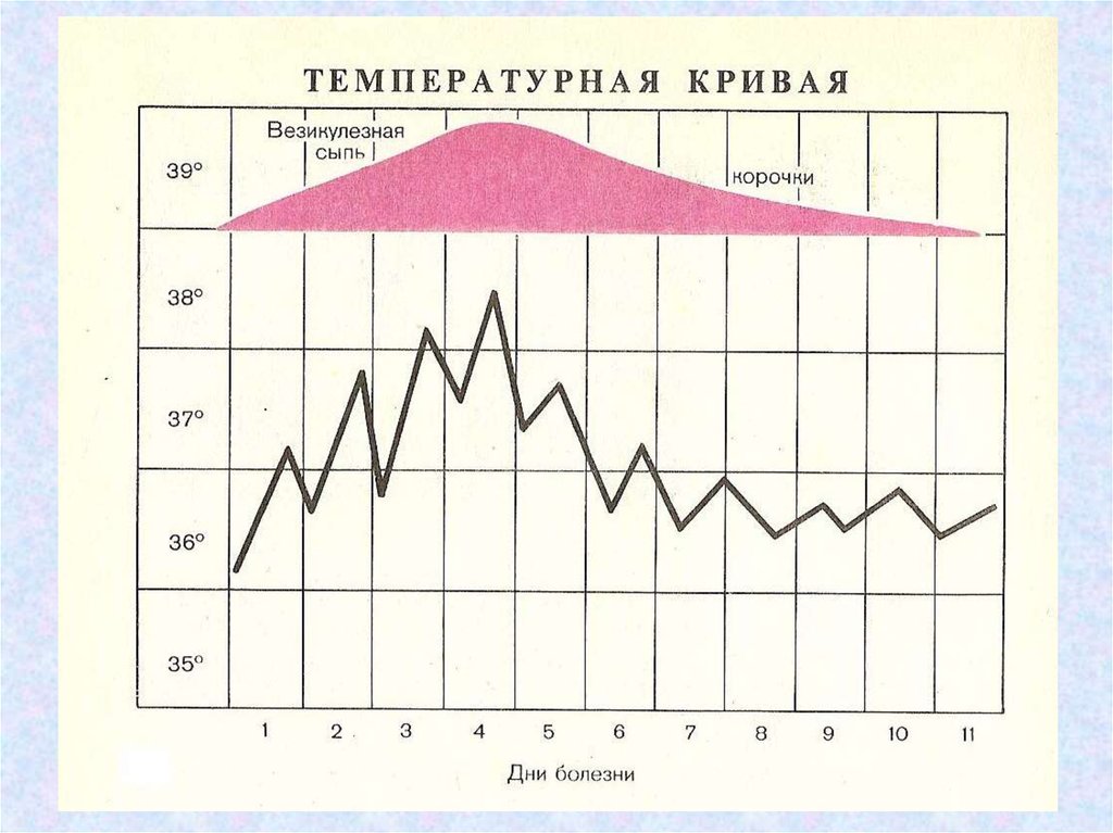 Сколько температура при кори. Корь температурная кривая. Температурная кривая при кори. Температурная кривая. Вид температурной Кривой при кори.