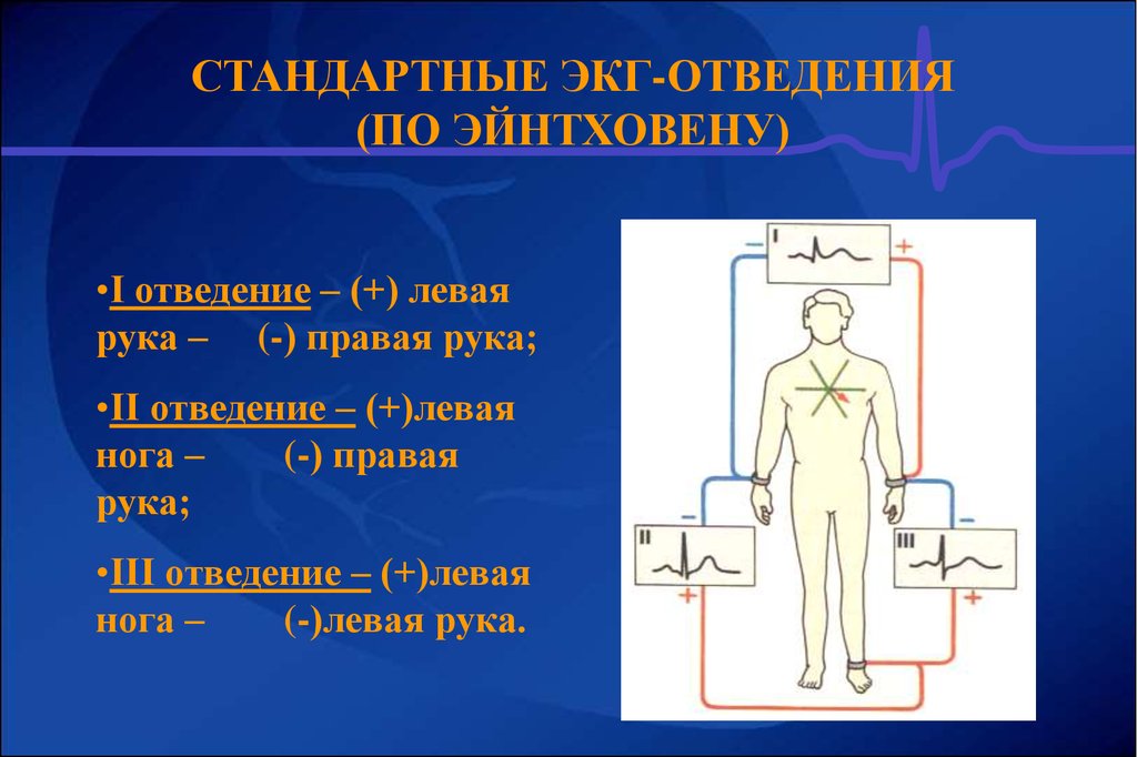 Электроды экг стандартные отведения. ЭКГ во 2 стандартном отведении. Отведения ЭКГ физиология. Стандартные электроды ЭКГ. Стандартных отведений в электрокардиографии.