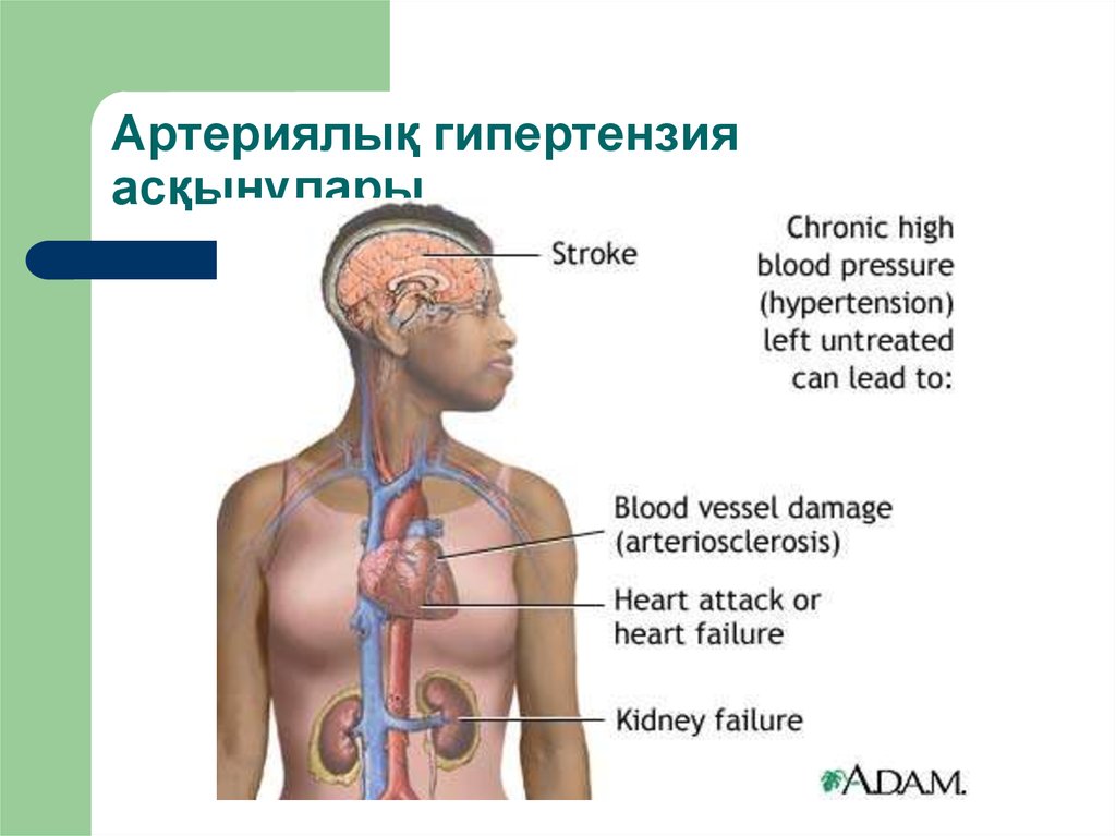 Артериялық гипертензия презентация қазақша