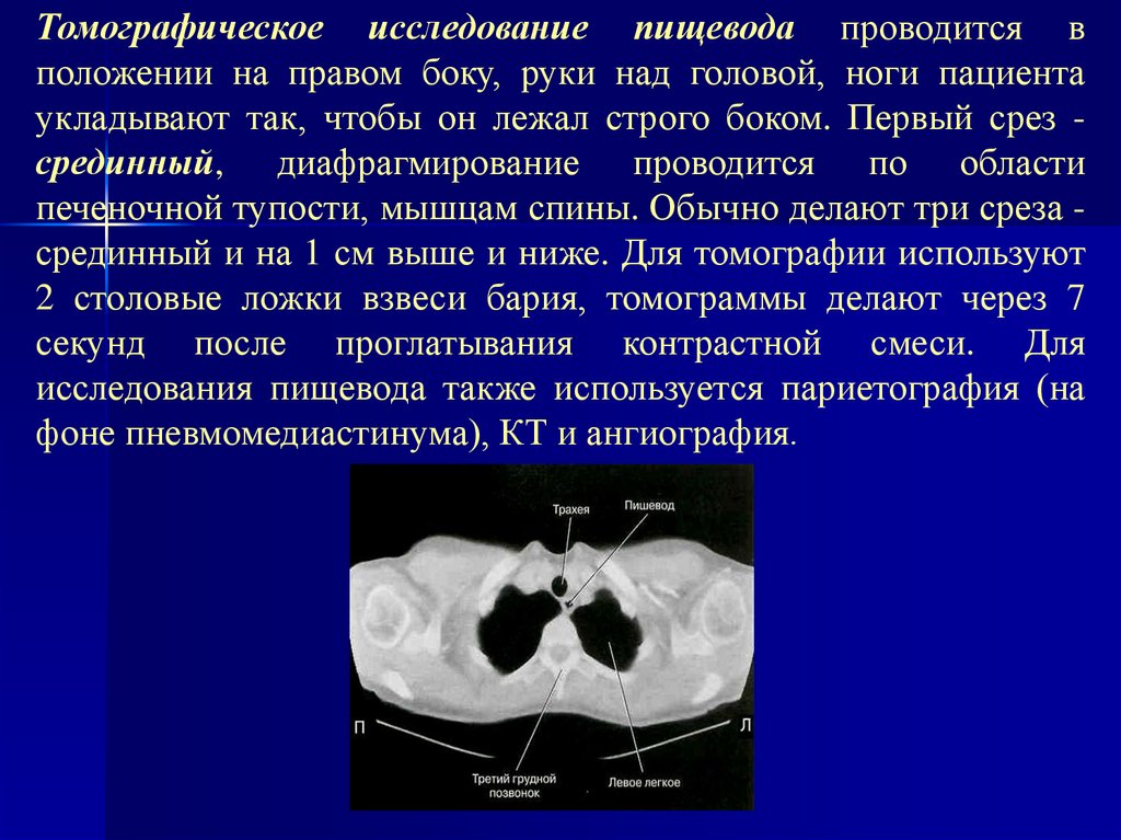 Исследование пищевода. Исследование пищевода проводится. Срезы в томографических исследованиях. Рентгеноанатомия печени.