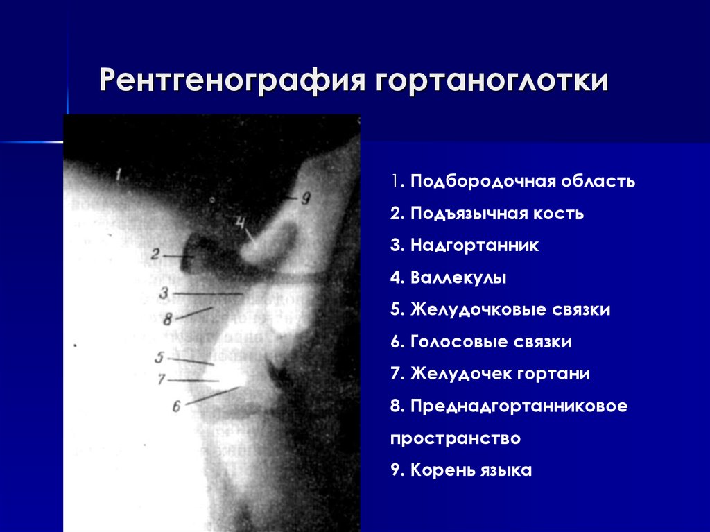 Схема описания рентгенограммы костей