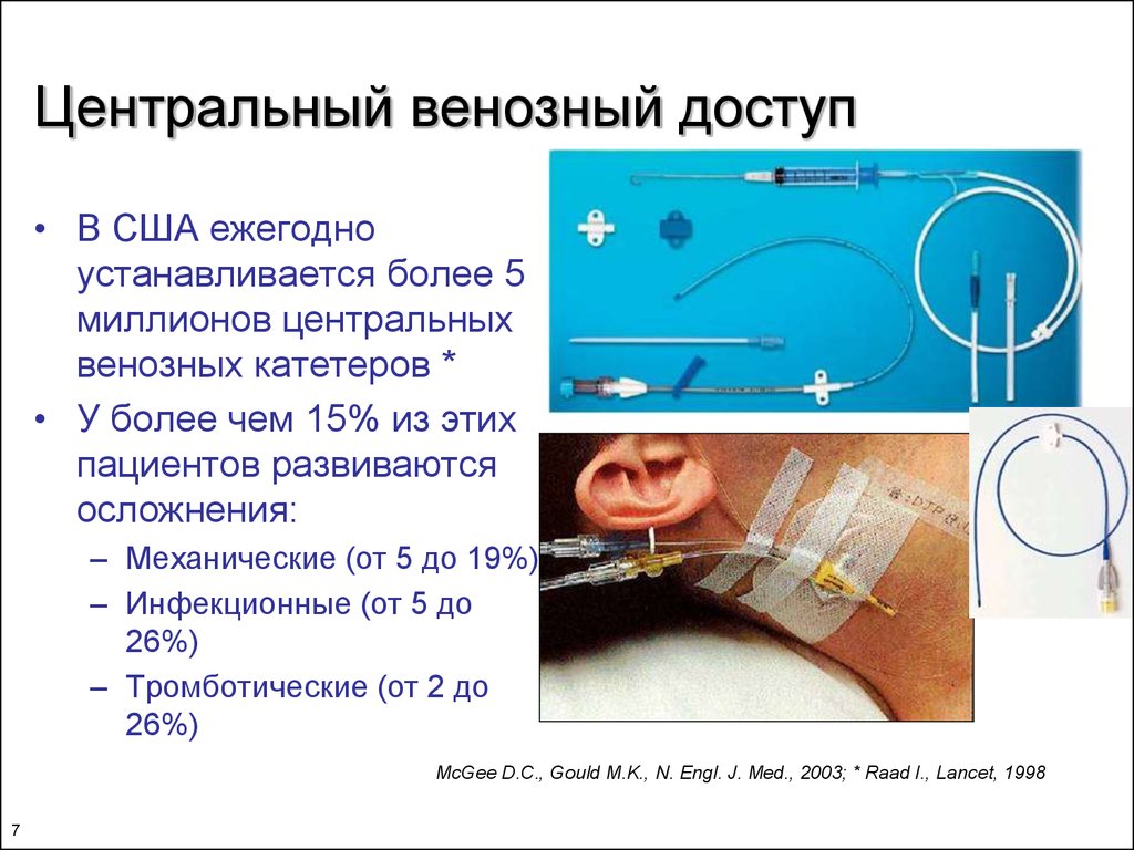 Центральное венозное. Центральный катетер венозный алгоритм. Центральный венозный катетер измерение ЦВД. Катетеризация центральной вены алгоритм. Центральный венозный катетер осложнения.