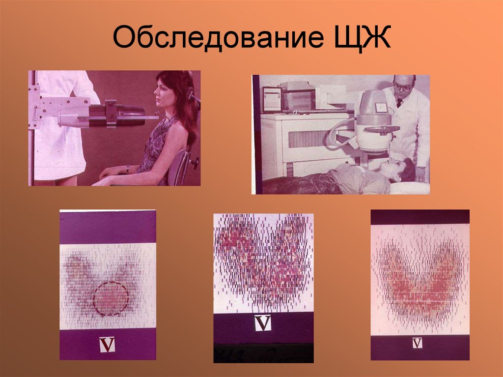 Обследование ЩЖ