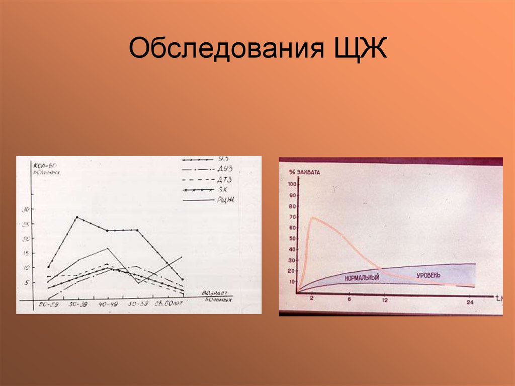 Обследования ЩЖ