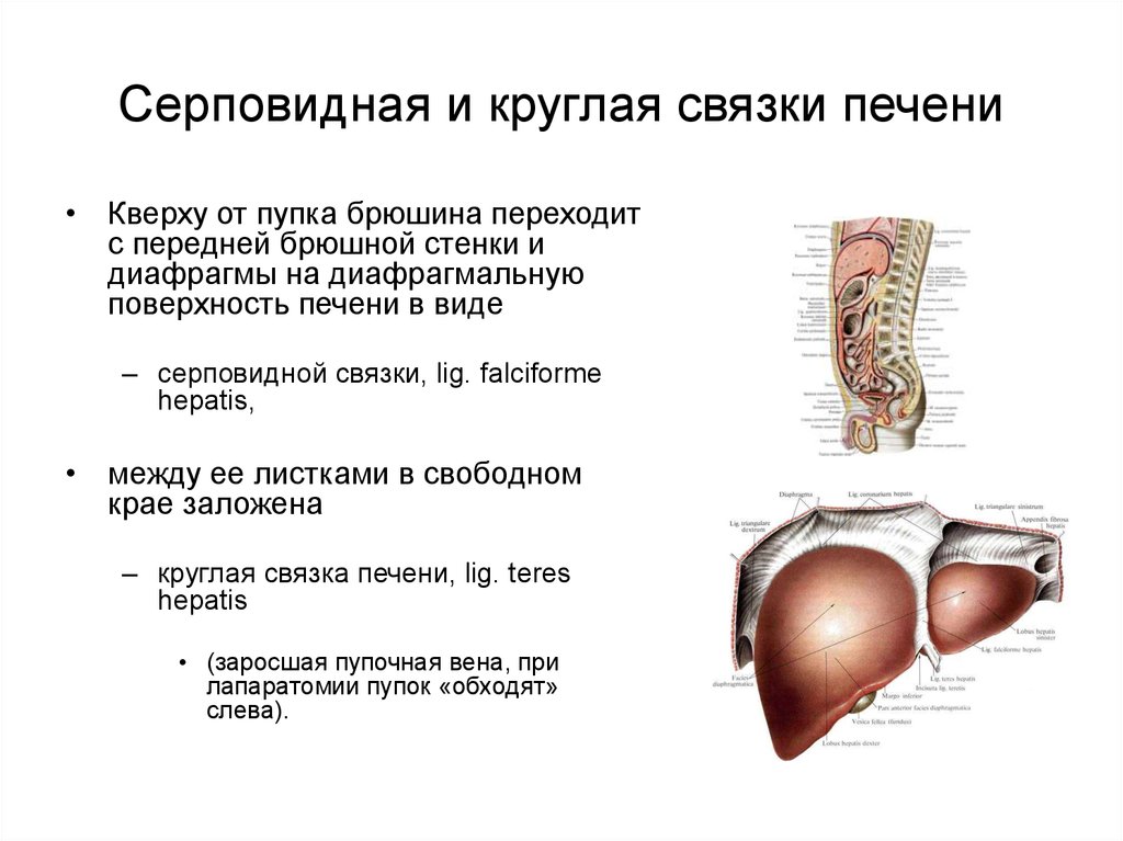 Круглая связка печени на узи фото