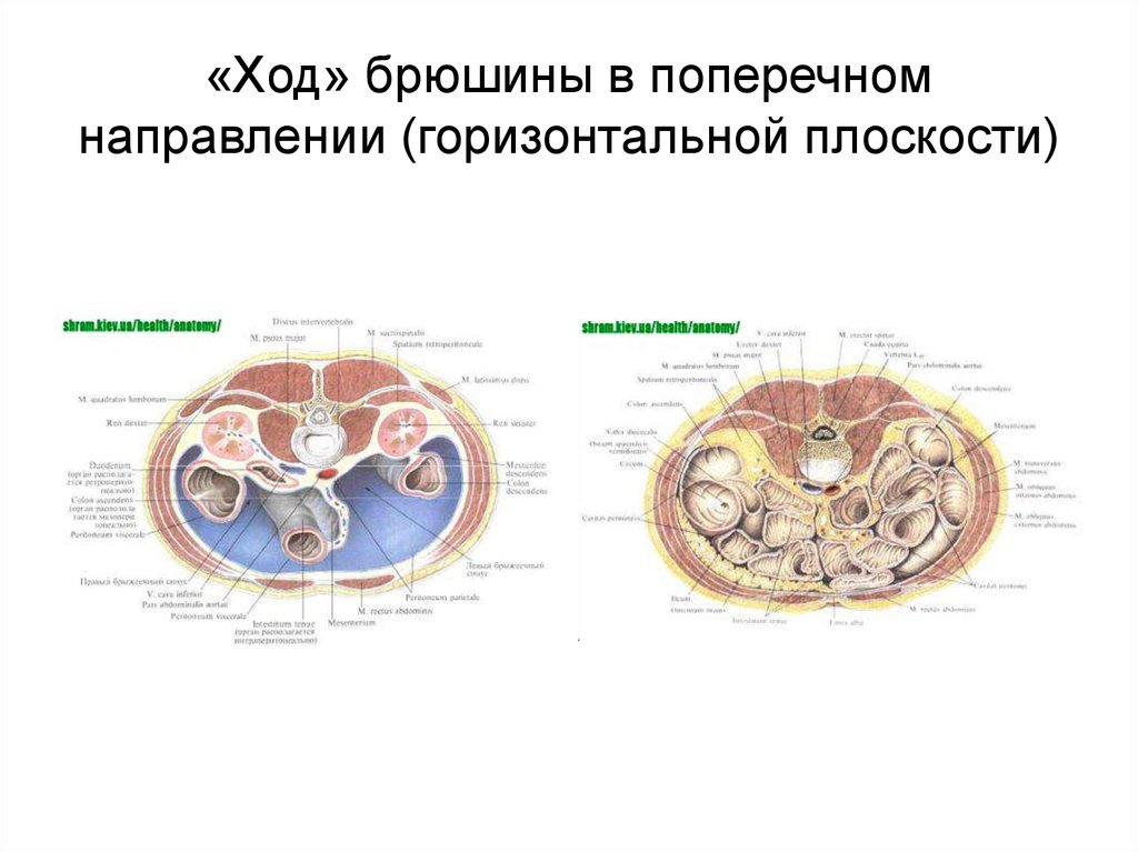 Сагиттальный и поперечный распил забрюшинного пространства схема