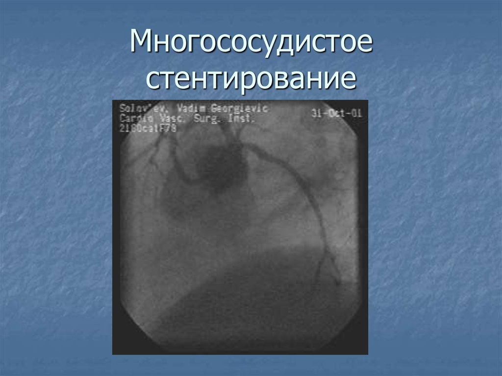 Диагностика пороков сердца картинки