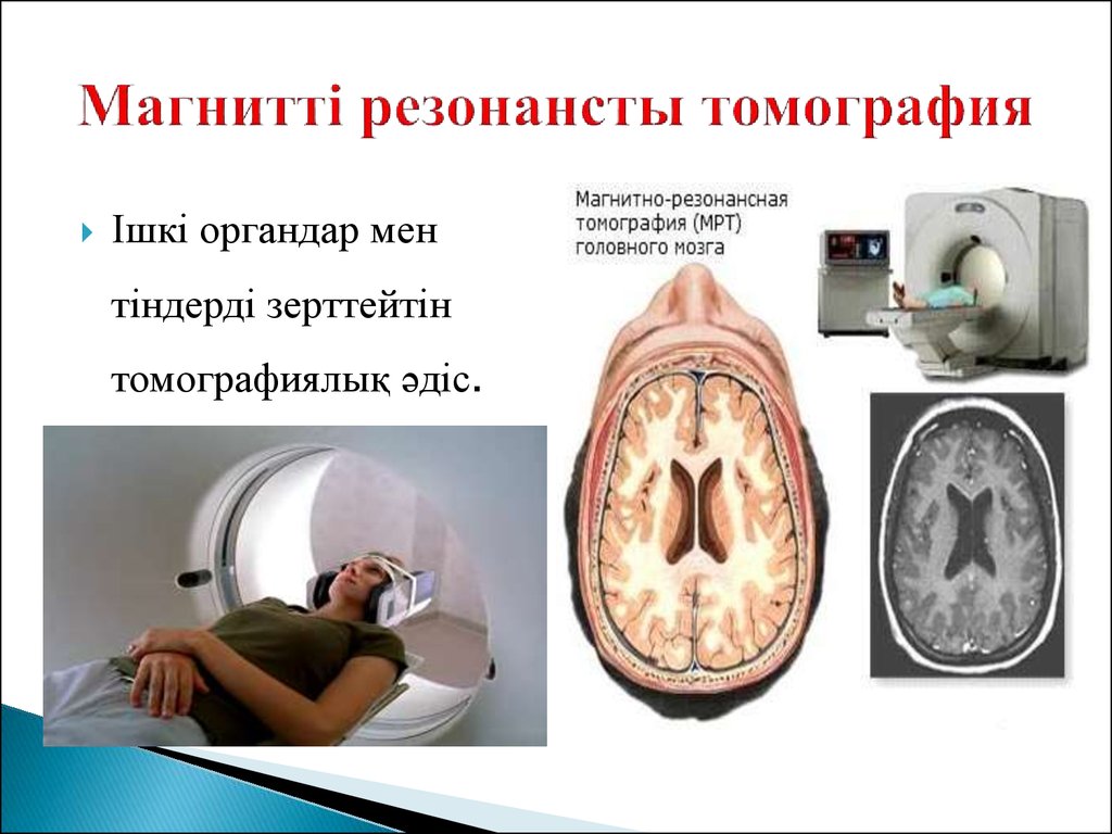 Магнитно резонансная томография презентация