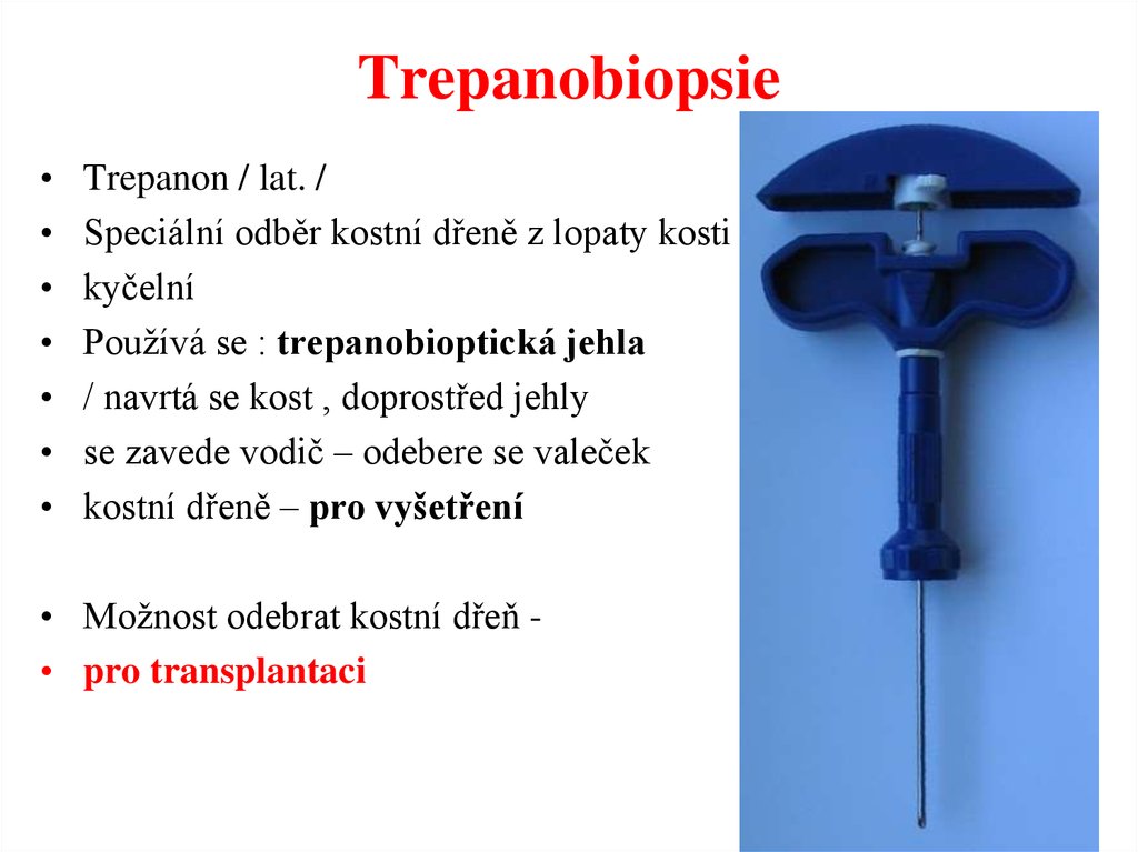 Trepanobiopsie