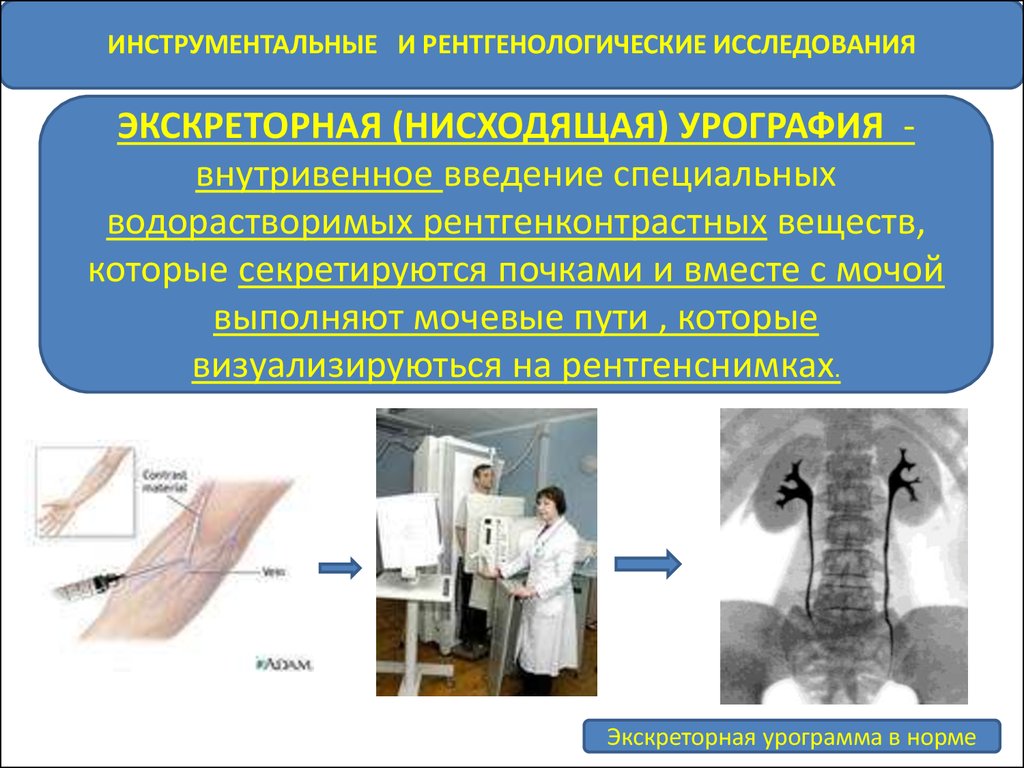 Функциональное исследование почек