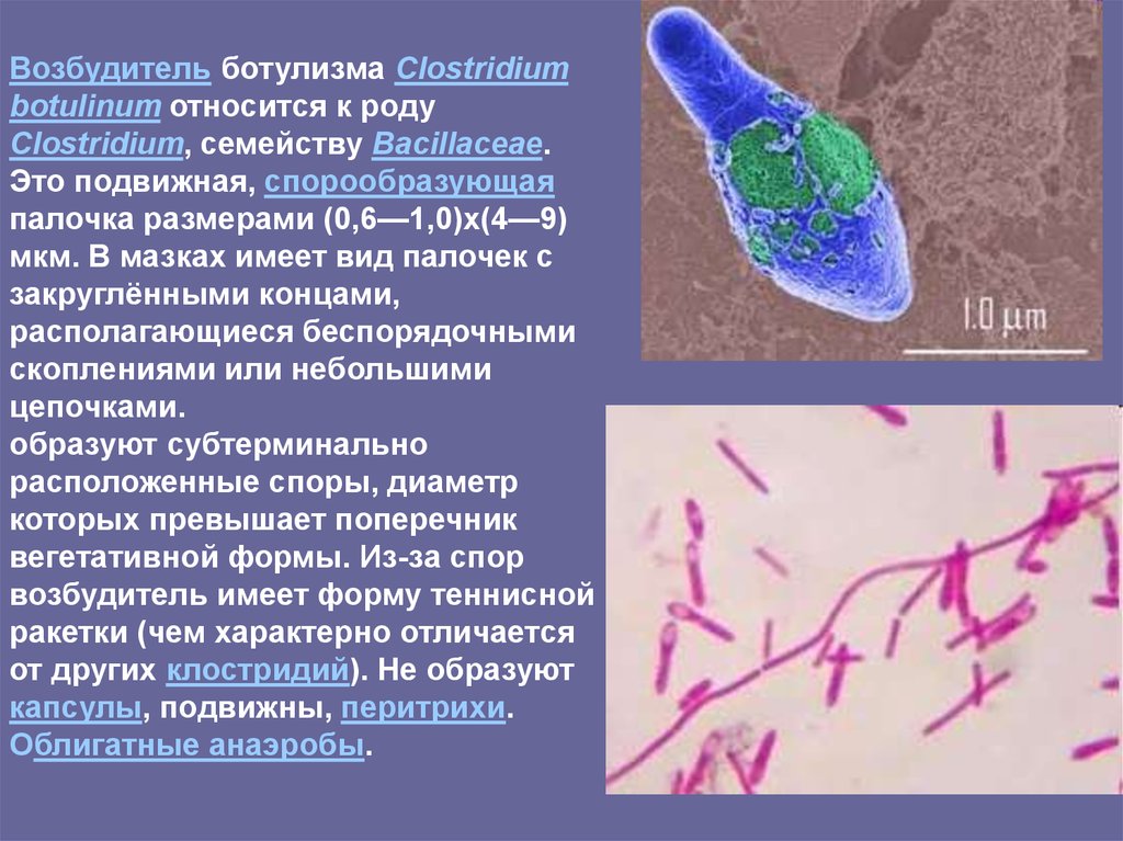 Возбудитель ботулизма рисунок