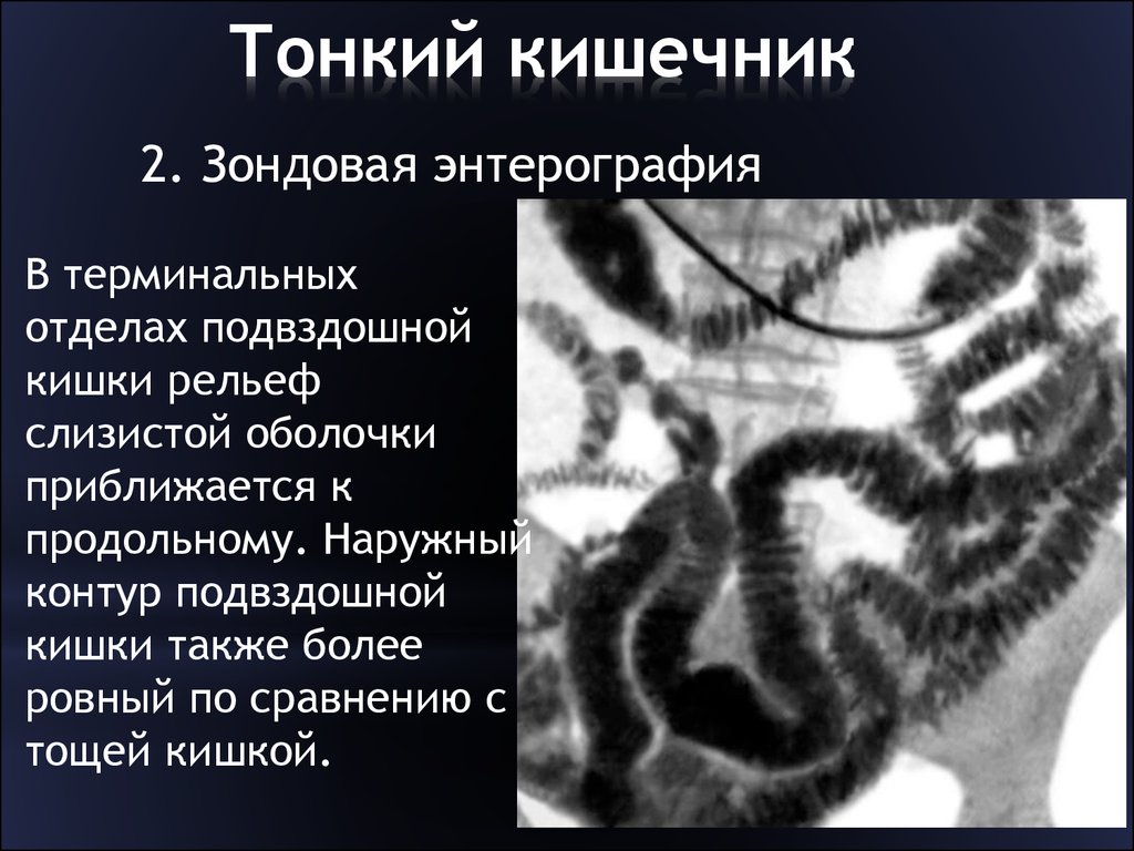 Реферат: Лучевые методы диагностики желудка и тонкого кишечника