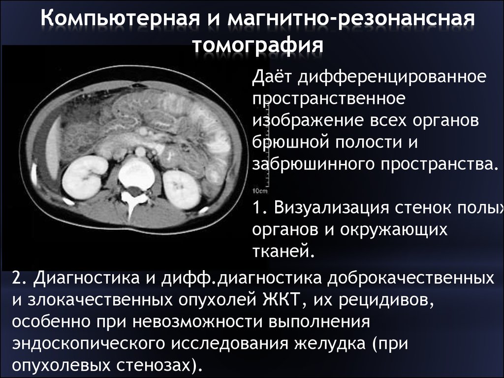 Что лучше кт или узи брюшной полости