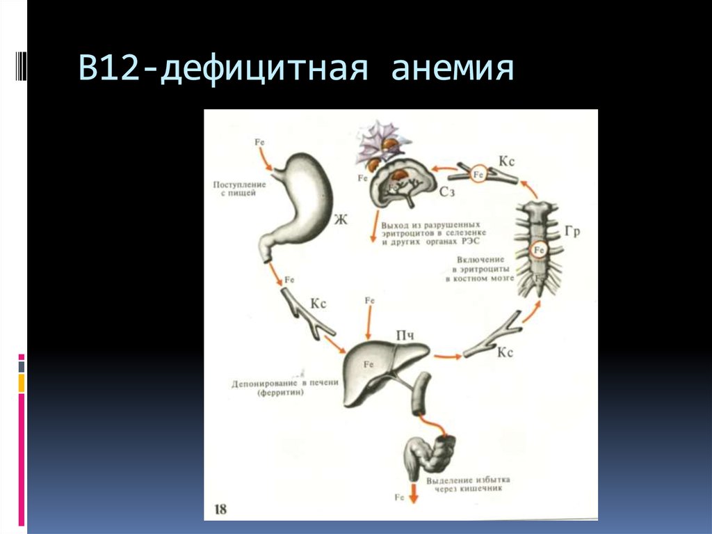 В12 дефицитная анемия презентация