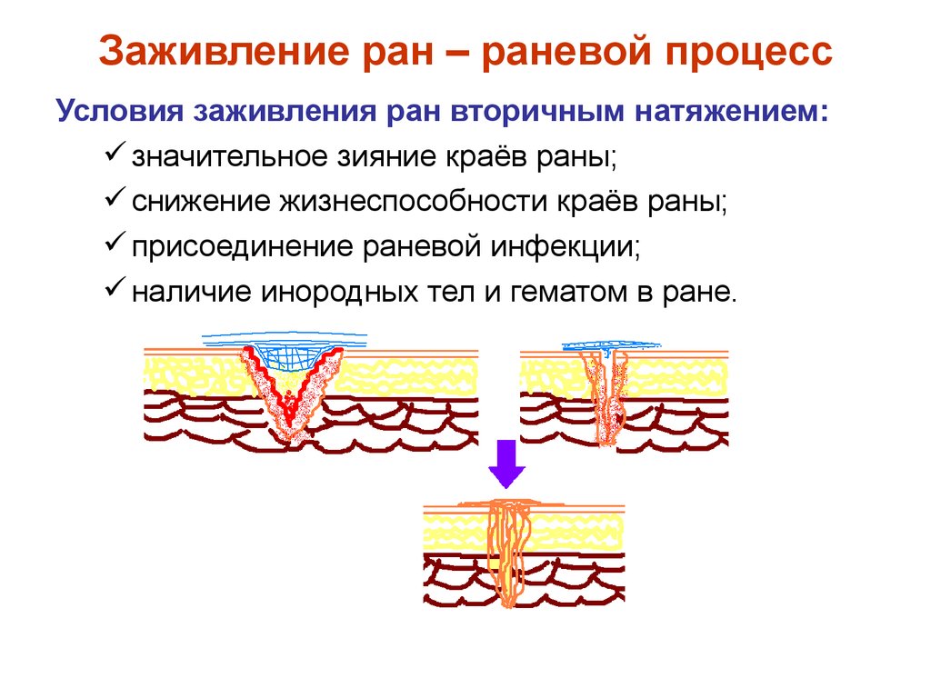 Что такое натяжение волос