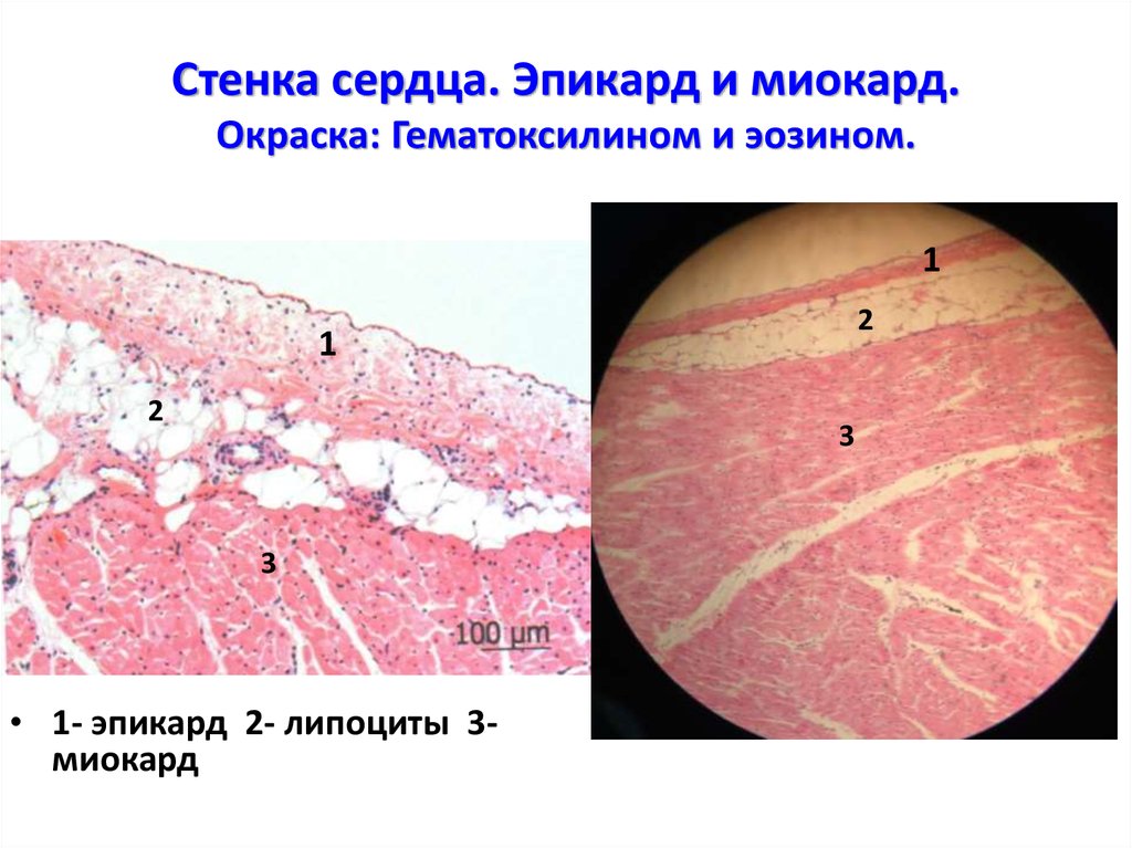 Миокард гистология рисунок