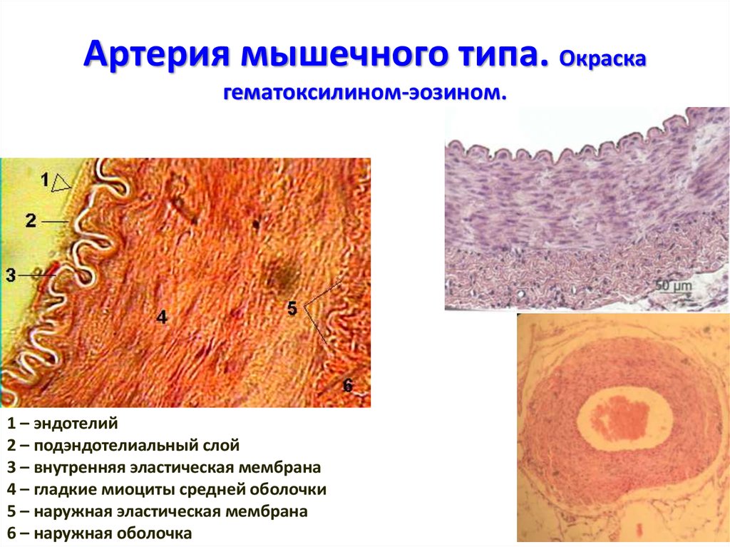 Рисунок артерии мышечного типа