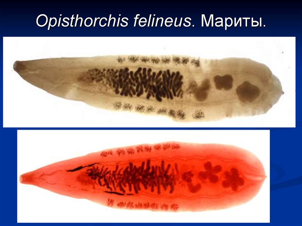 Описторхоз это. Opisthorchis felineus Кошачья двуустка. Кошачий (Сибирский) сосальщик (Opisthorchis felineus). Сибирский сосальщик Марита. Кошачья (Сибирская двуустка) описторх.