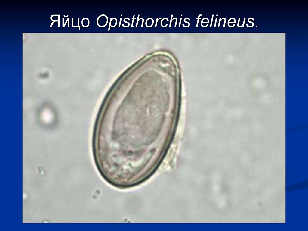 Яйца сосальщиков. Яйца кошачьего сосальщика микроскоп. Яйца кошачьего сосальщика препарат. Яйца кошачьего сосальщика под микроскопом. Яйцо двуустки кошачьей - Opisthorchis felineus.