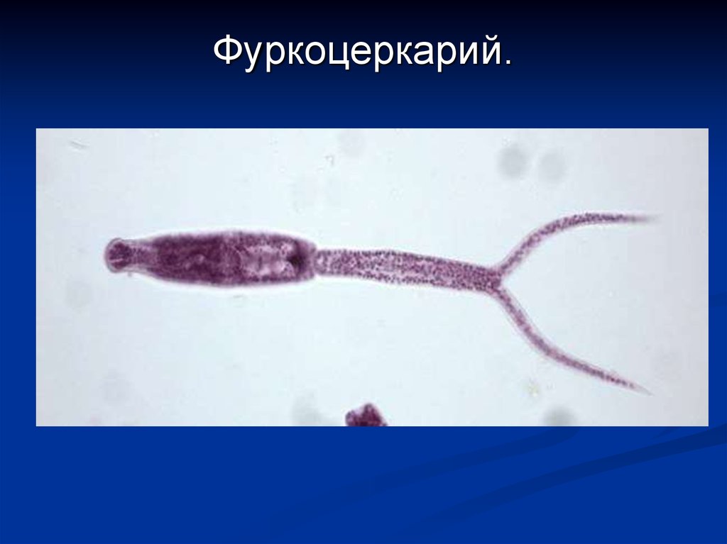 Церкарии. Trematoda церкария. Фуркоцеркарий. Церкарии под микроскопом. Строение личинка церкария.