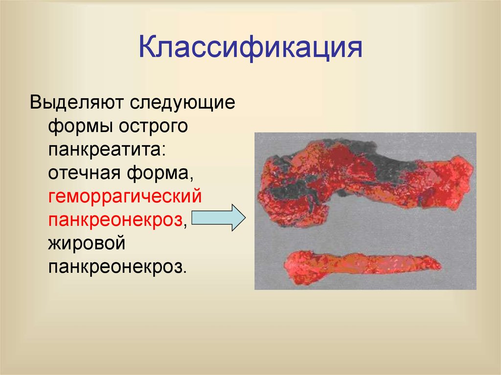 Классификация