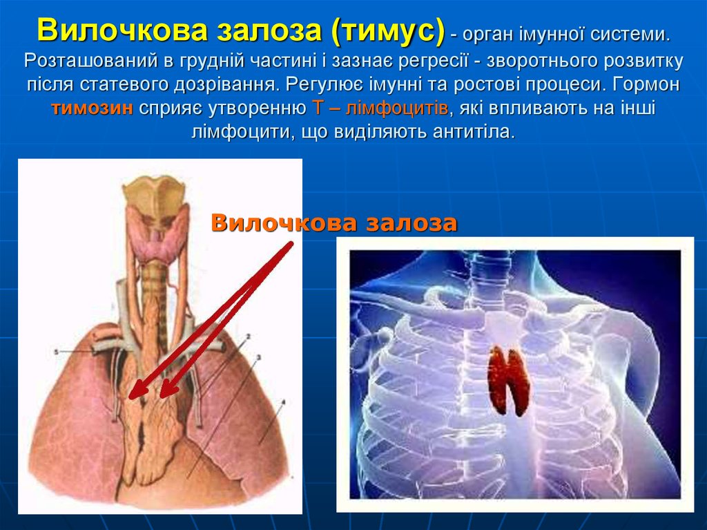 Вилочкова залоза (тимус) - орган імунної системи. Розташований в грудній частині і зазнає регресії - зворотнього розвитку після статевого д