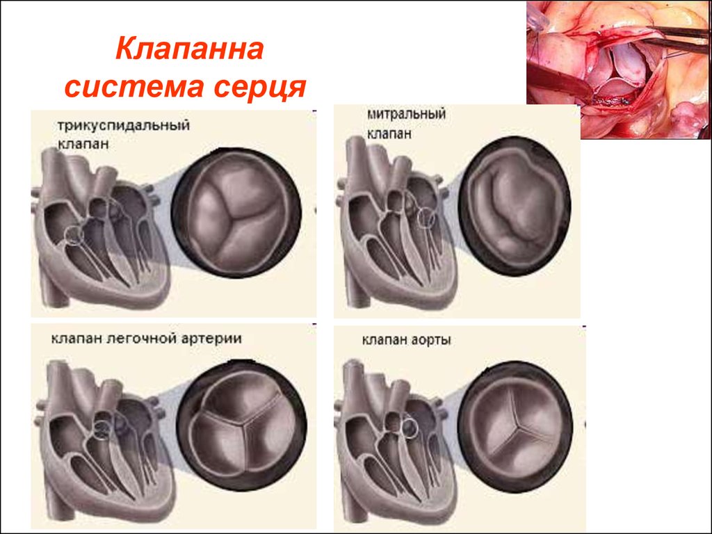 Клапанна система серця