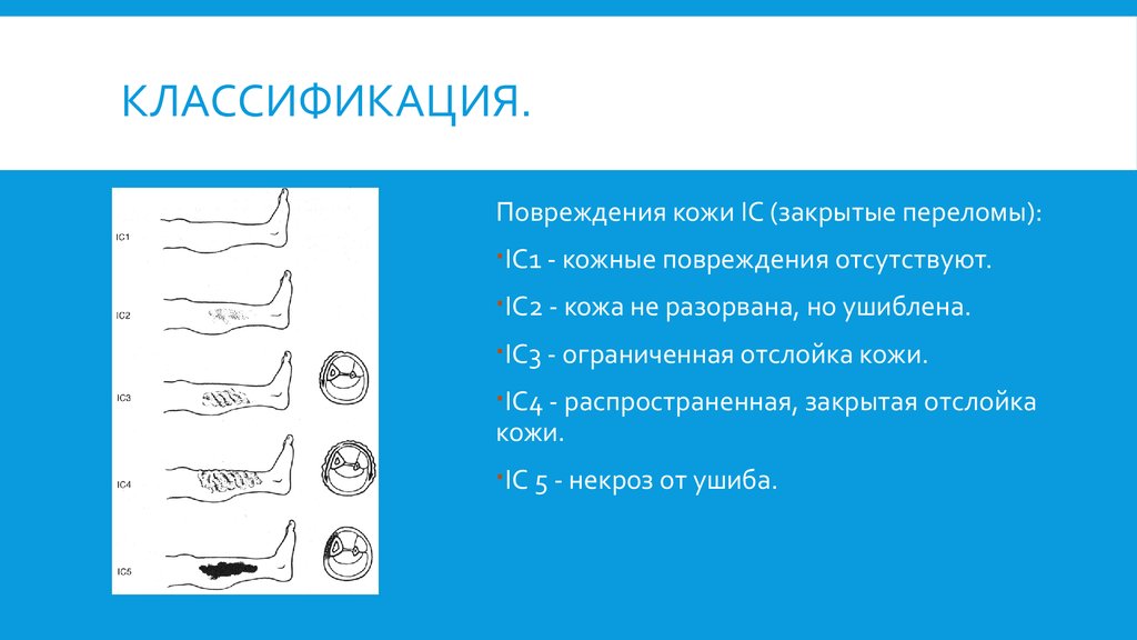 Повреждения отсутствуют. Классификация повреждений кожи. Классификация переломов длинных трубчатых костей ao/Asif.