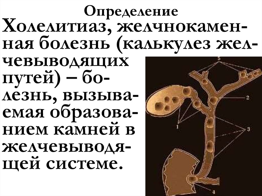 Определение