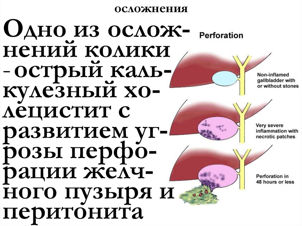 осложнения