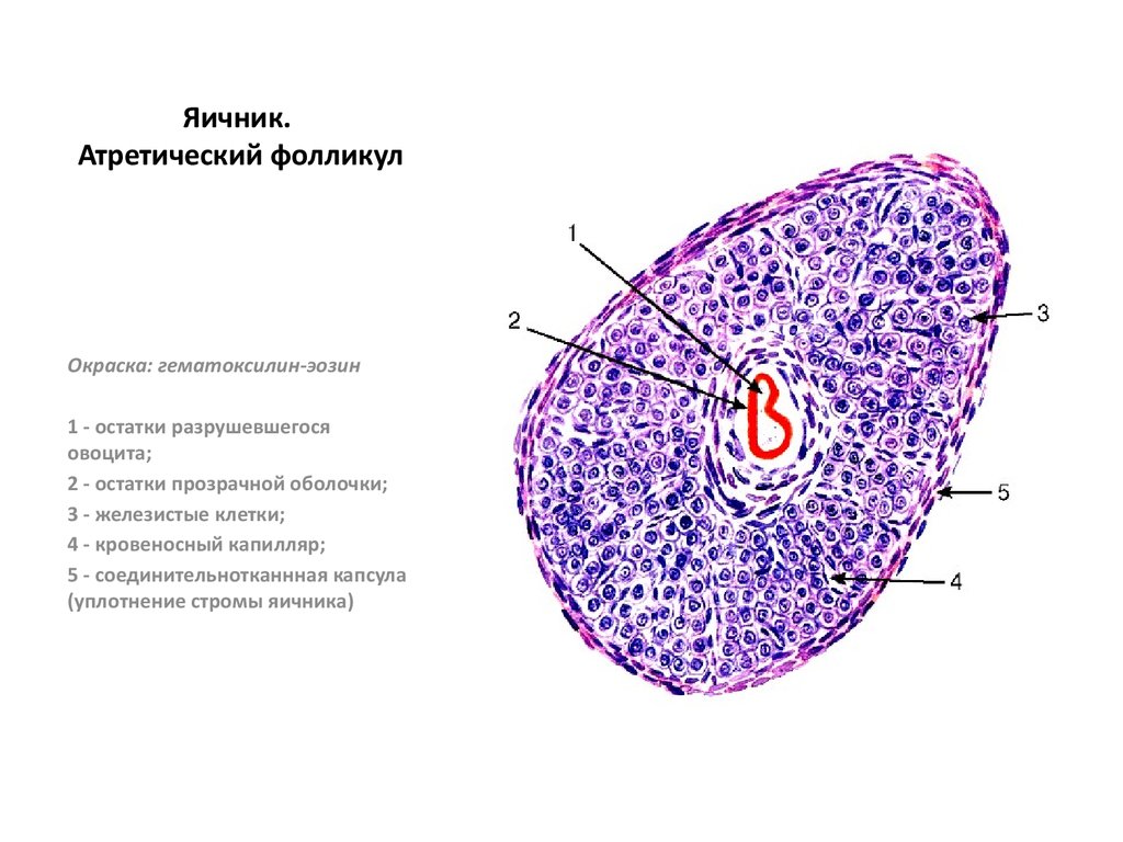 Желтое тело гистология рисунок