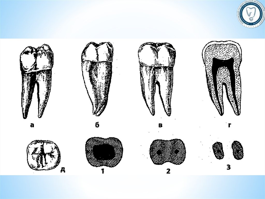 Коренной зуб в челюсти. Второй моляр нижней челюсти анатомия. Второй моляр нижней челюсти правый. Второй Нижний моляр анатомия. Анатомия второго моляра нижней челюсти.