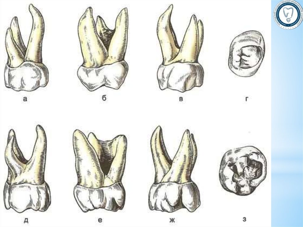 Коренной зуб в челюсти. 1 Моляр верхней челюсти анатомия. Анатомия 1го моляра верхней челюсти. Молочный моляр верхней челюсти.