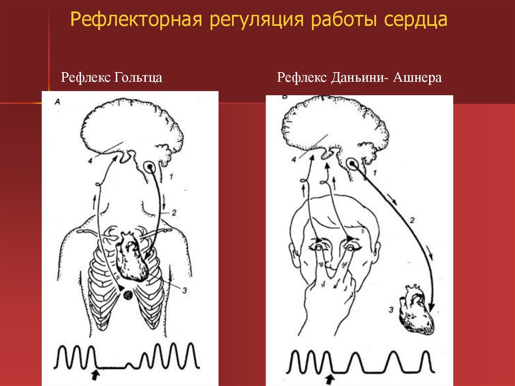 Рефлекс парина схема