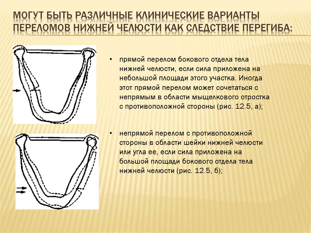 Закрытый перелом нижней челюсти карта вызова локальный статус