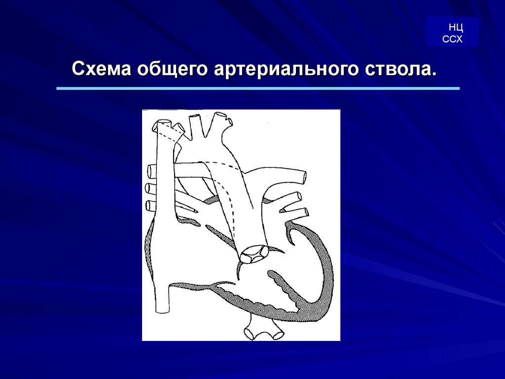 Общий артериальный ствол презентация