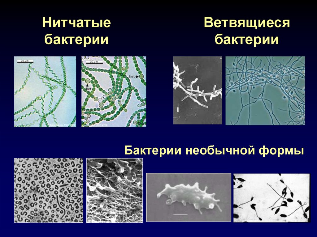 Нитевидные бактерии. Нитчатые бактерии микробиология. Ветвящиеся нитевидные формы бактерий. Актиномицеты ветвящиеся бактерии. Нитчатые формы бактерий актиномицеты.