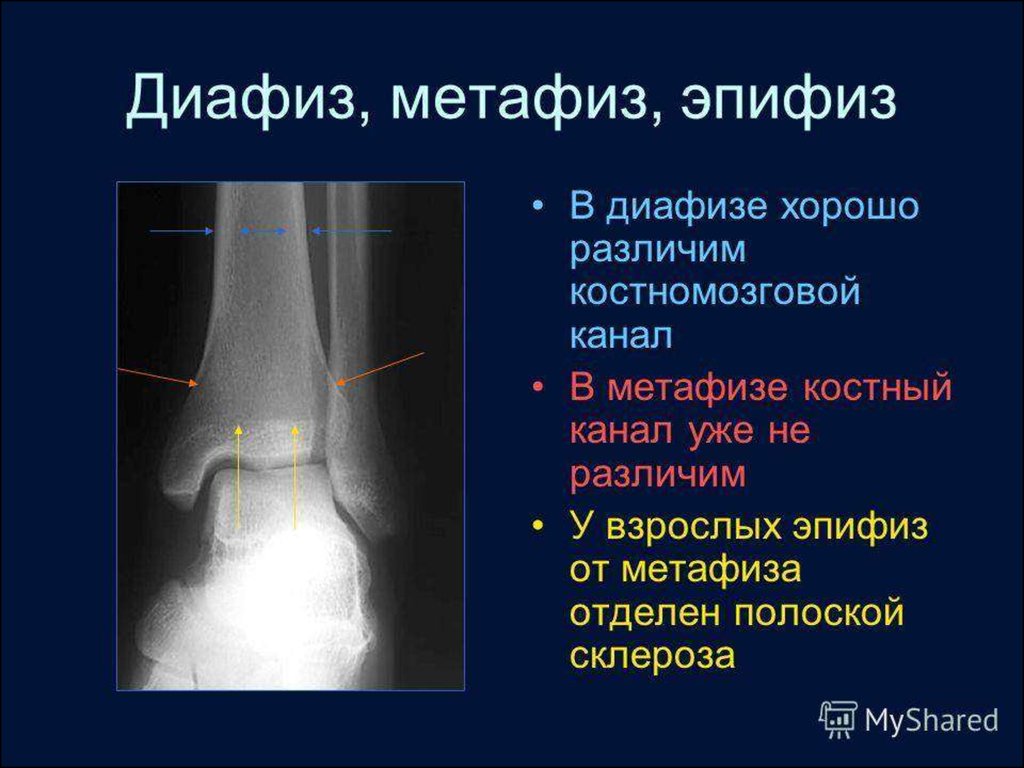 Костно трубчатый канал