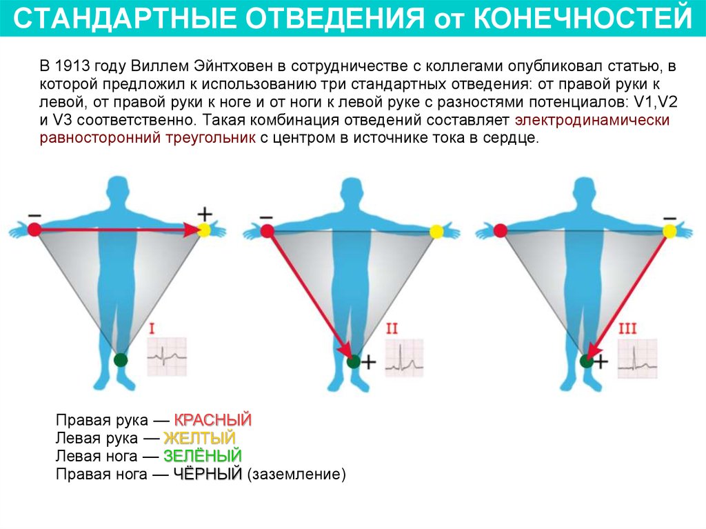 Картинка стандартные отведения