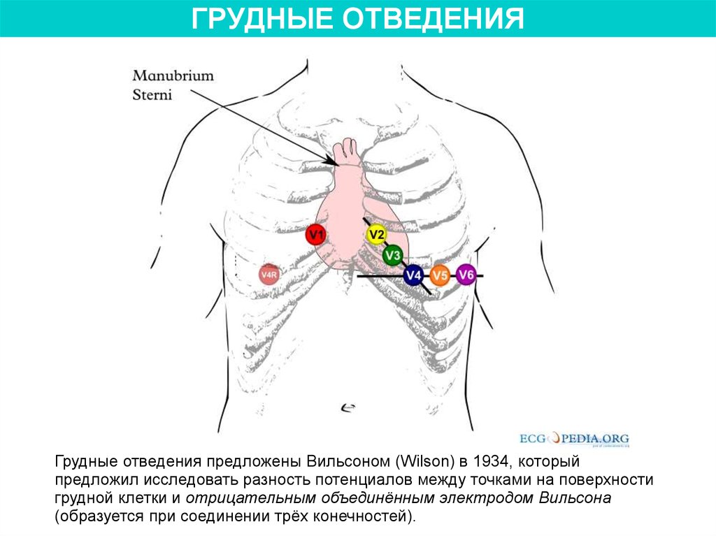 Схема установки холтера на грудной поверхности показать