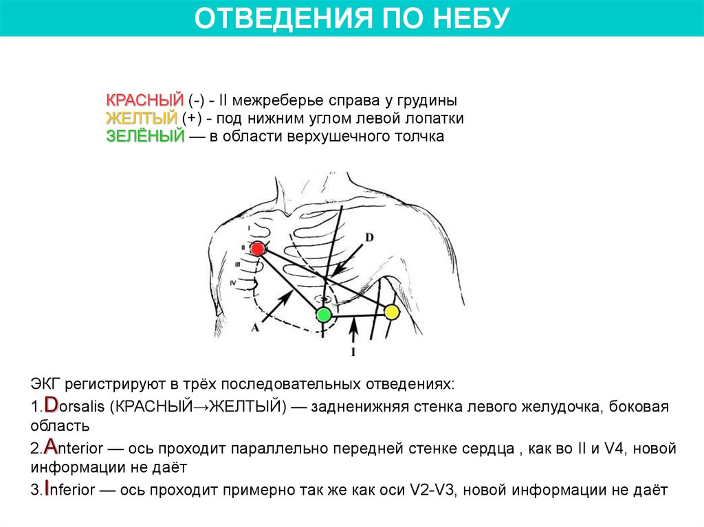 Экг как снять схема