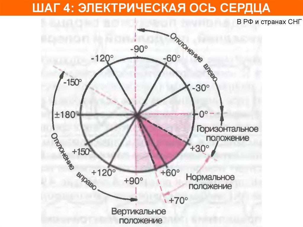 Определение осей сердца