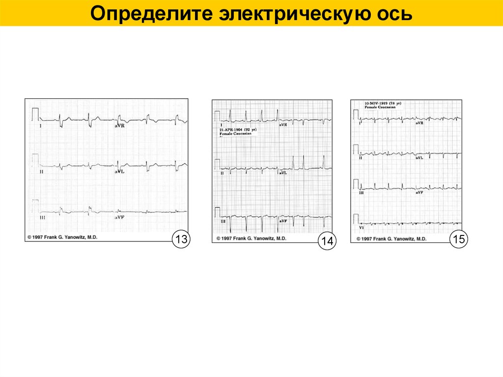 Экг определение. Газоанализатор ЭОС. Эхоофтальмоскоп ЭОС-22. ЭОС 1 220.