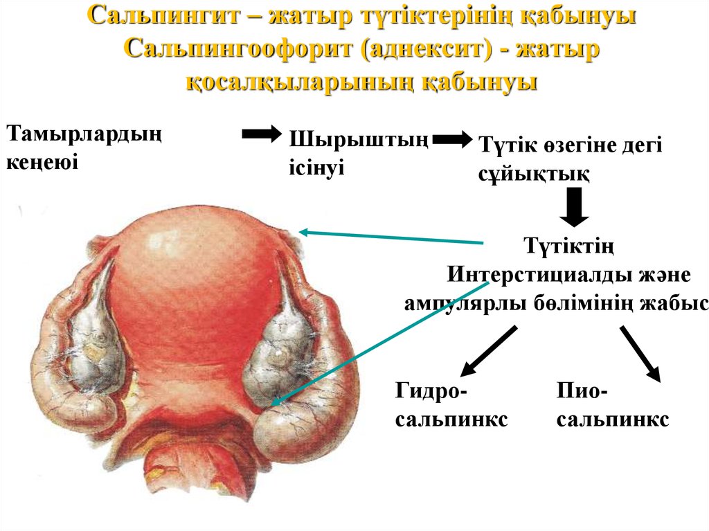 Әйел жыныс мүшелерінің қабыну аурулары презентация