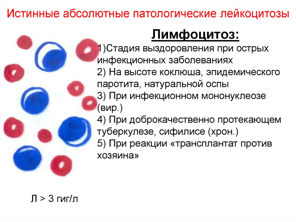 Лейкоцитоз причины у женщин