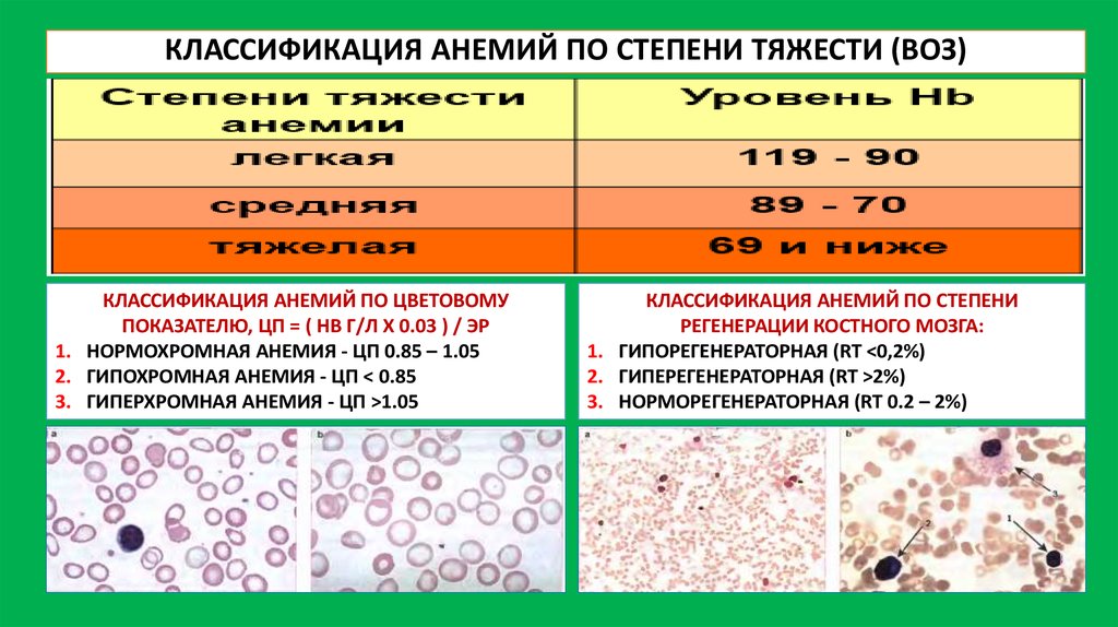 Гипохромная анемия степени